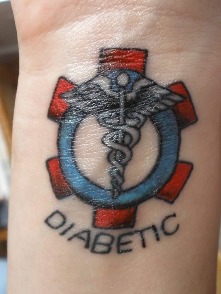 Diabet si tatuaje