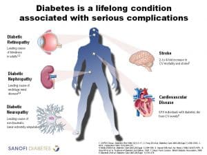 Complicatii diabet