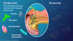 Diabet zaharat prin afectarea pancreasului exocrin