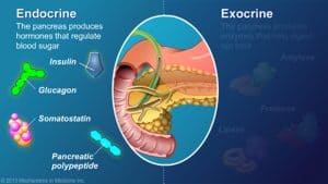 Diabetul zaharat prin afectarea pancreasului exocrin