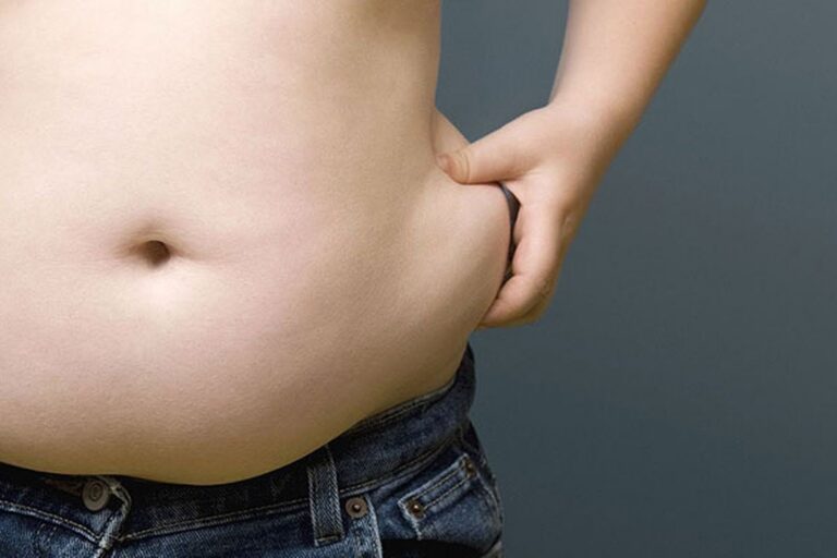 Obezitatea – aspecte patologice genito-urinare