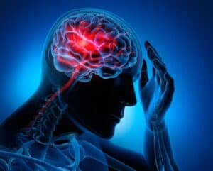 Accidentul vascular cerebral