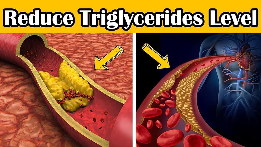 De ce cresc trigliceridele